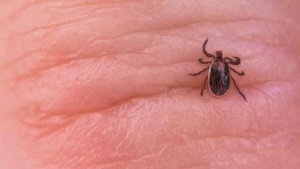 From Athlete to Ailment: Tick Bite Leaves Fitness Influencer Paralyzed, Raising Awareness of Lyme-Like Diseases