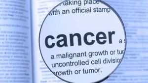1 in 3 cancers is preventable: Oncologist shares 5 lifestyle habits to lower cancer risk