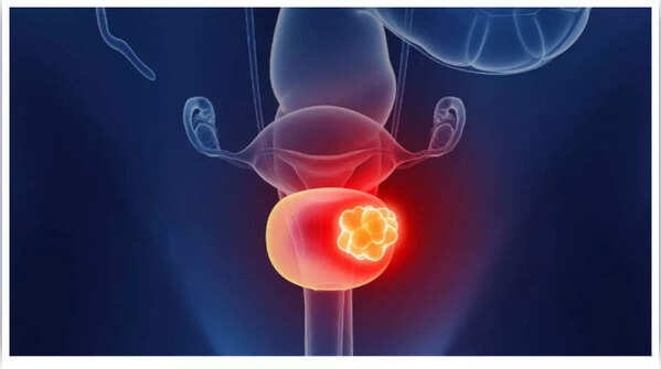 Woman experiencing lower back pain