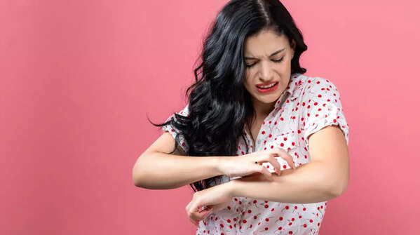 An itchy and bleeding mole, a possible sign of skin cancer.
