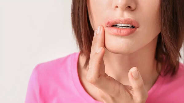 Close-up of a non-healing skin sore.