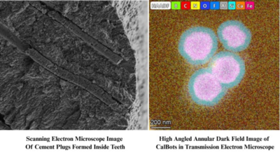 IISc, startup develop magnetic nanobots to treat tooth sensitivity